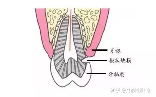 带把吉他去沙滩 我在自弹轻轻唱