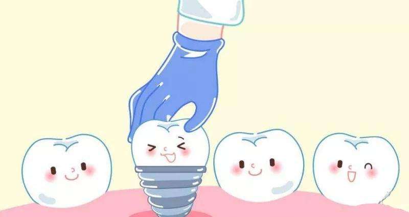 哪些患者适合口腔种植