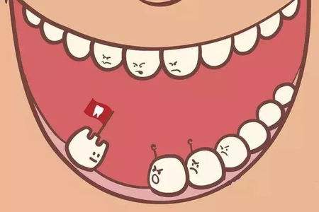 有哪些方法可以预防龋齿
