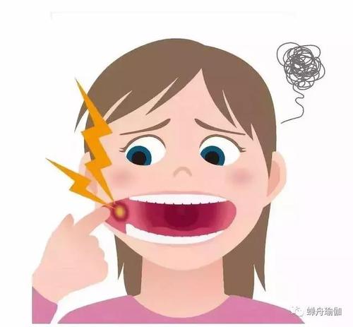 口腔溃疡也可能是压力过大引起