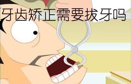 口腔正畸为何要拔牙