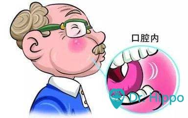 漱口时要鼓腮
