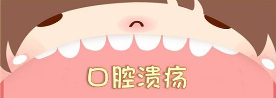 什么是口腔溃疡