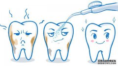 洗牙会使牙齿变松吗