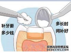 福州补牙多少钱一颗？补一次牙能用多久？