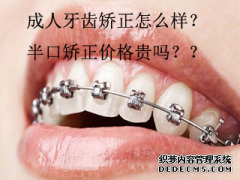 长乐成人做牙齿矫正怎么样？整半口牙需要多少