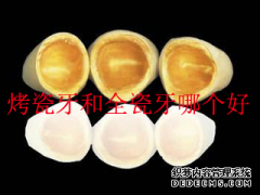 福州做烤瓷牙与全瓷牙哪个好？两者有什么区别