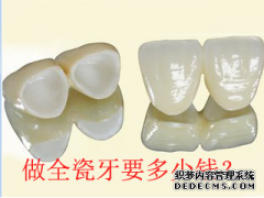 福州做全瓷牙价格？做两颗全瓷牙要多少钱？