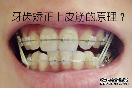 图片13.png