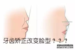 [福州]牙齿矫正脸型变化图，牙齿矫正的步骤？