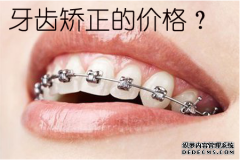 [福州]牙齿矫正价格表，现在牙齿矫正要多少钱？