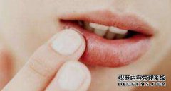 左下大牙牙龈肿痛怎么办？