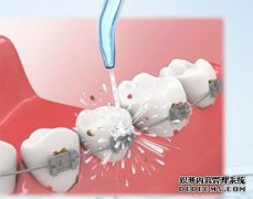 为什么需要定期洗牙？