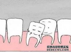 牙齿晃动了怎么办