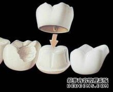 做颗美容冠能用多长时间？