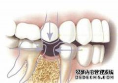 牙齿松动怎么办？