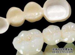 做完美容冠之后的注意事项
