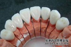 洗牙真的可以美白牙齿吗？