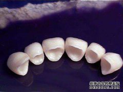 美容冠矫正牙齿好不好？