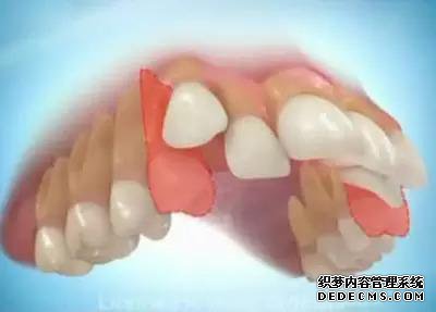 u=1357483812,2225317603&fm=27&gp=0.jpg