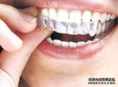 箍牙齿会很痛吗?