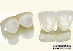 美容冠矫正龅牙的优势有哪些？