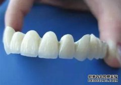 烤瓷牙患者要如何护理？
