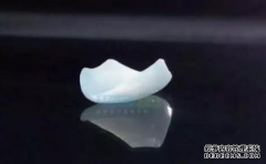 全瓷贴面的优势体现在哪几个方面？