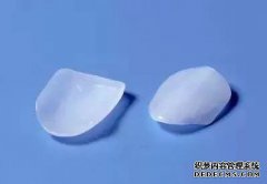 瓷贴面修复牙齿的效果好吗？