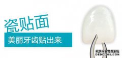 做完瓷贴面后该如何护理呢？