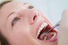烤瓷牙、全瓷牙与瓷贴面有什么不同呢？