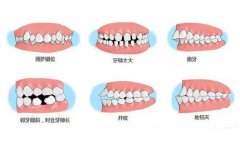 【福州】牙齿不矫正行不行？