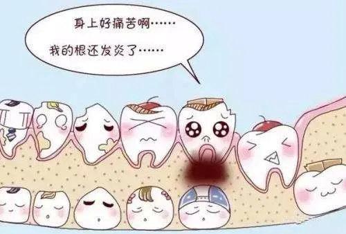 【福州】孩子乳牙蛀牙了需要治吗？补牙会好吗